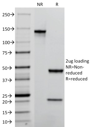 Data from SDS-PAGE analysis of Anti-TROP2 antibody (Clone TACSTD2/2152). Reducing lane (R) shows heavy and light chain fragments. NR lane shows intact antibody with expected MW of approximately 150 kDa. The data are consistent with a high purity, intact mAb.